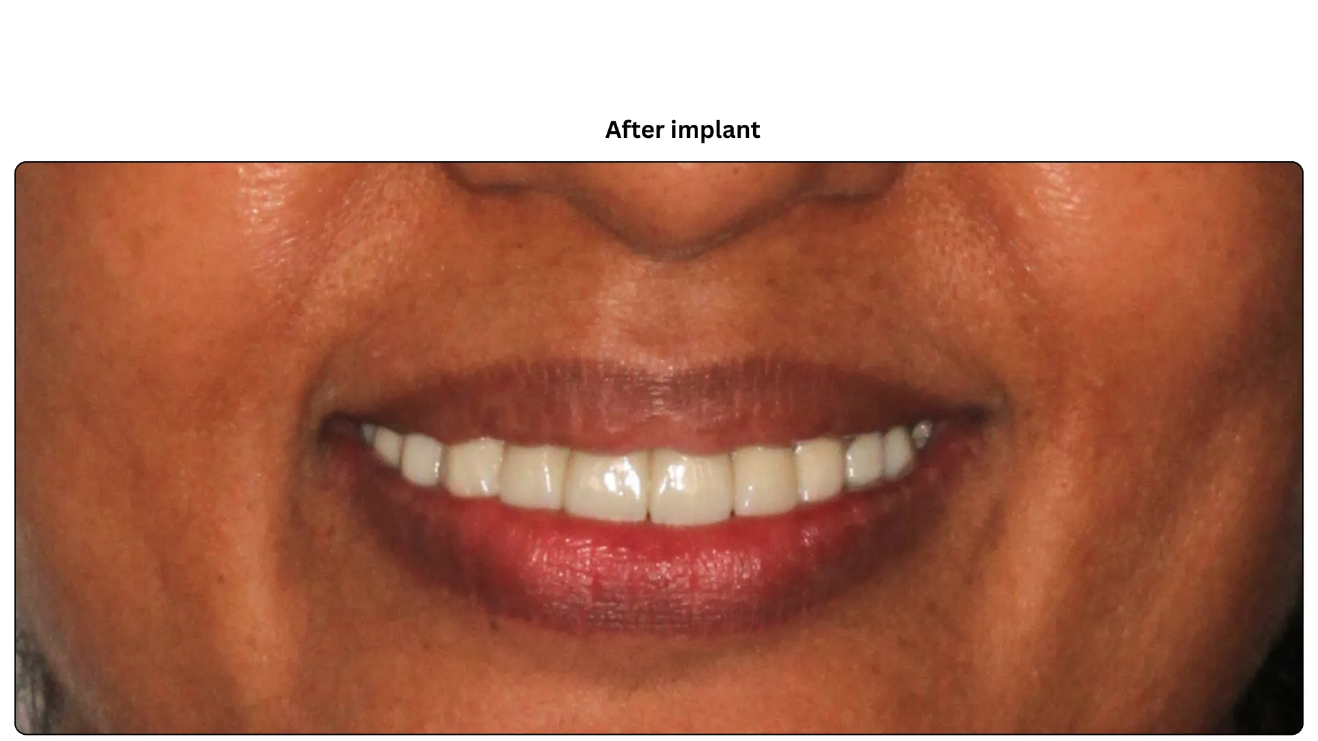 Daxayani after treatment