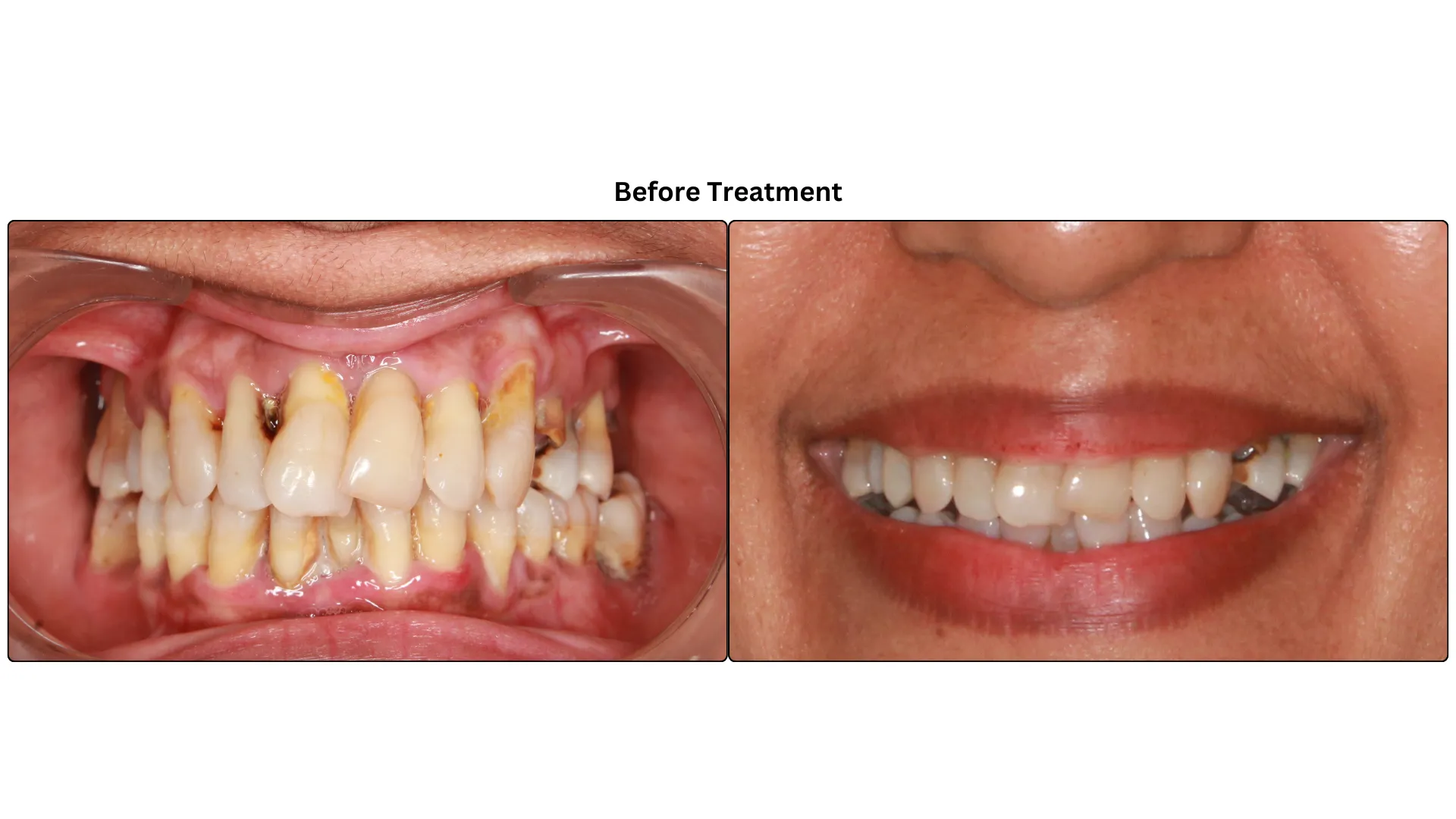 Daxayani before treatment
