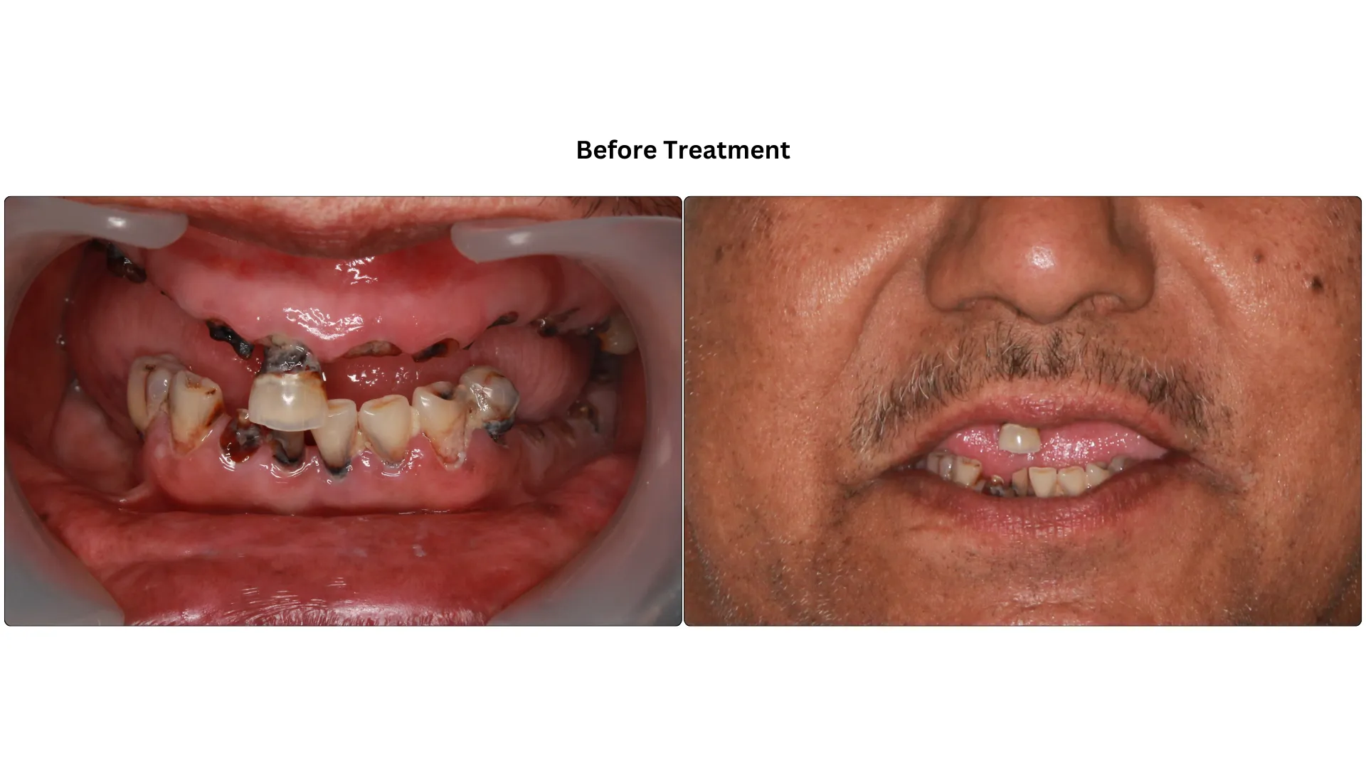 Daxayani before treatment
