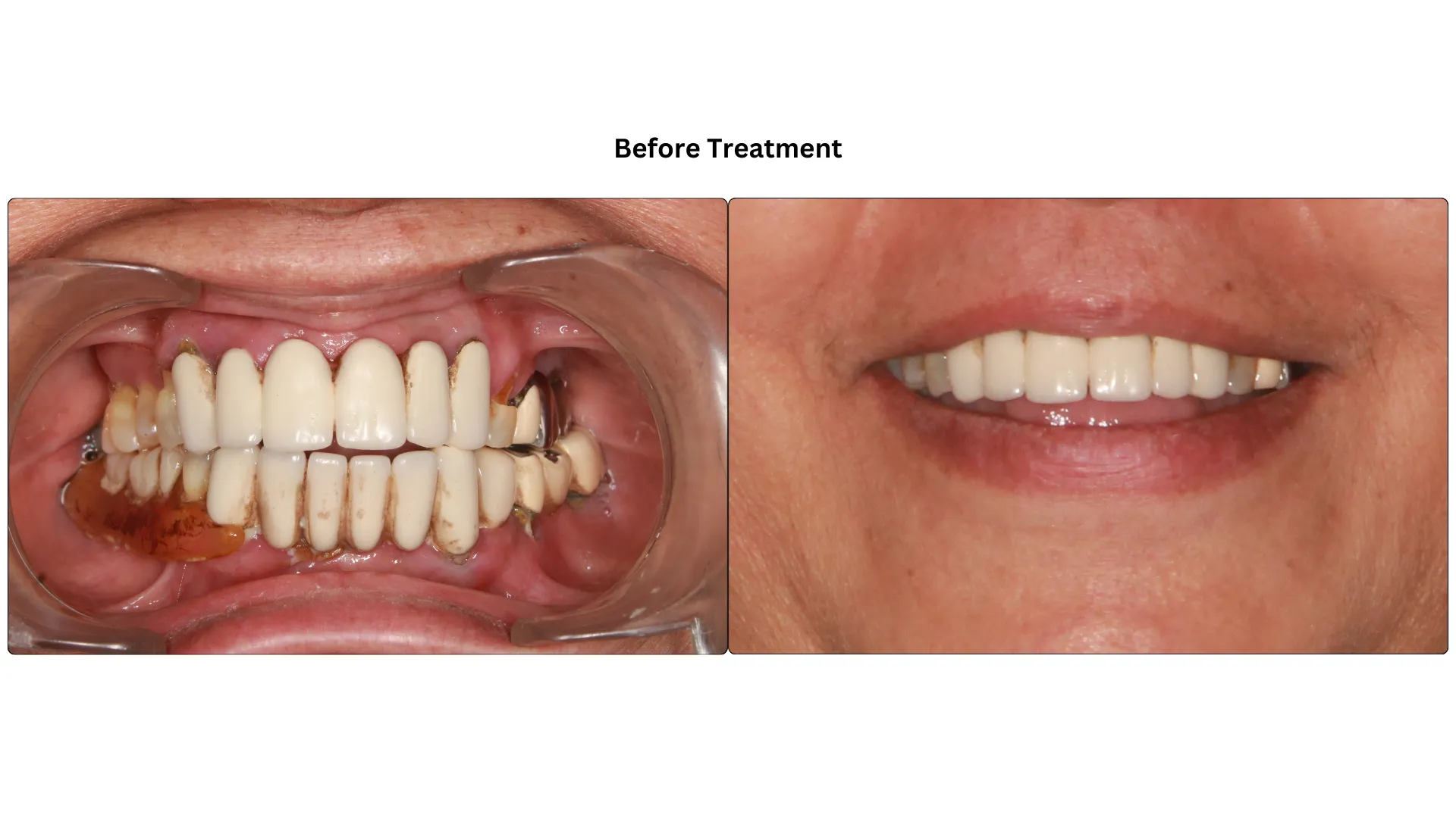 Daxayani before treatment