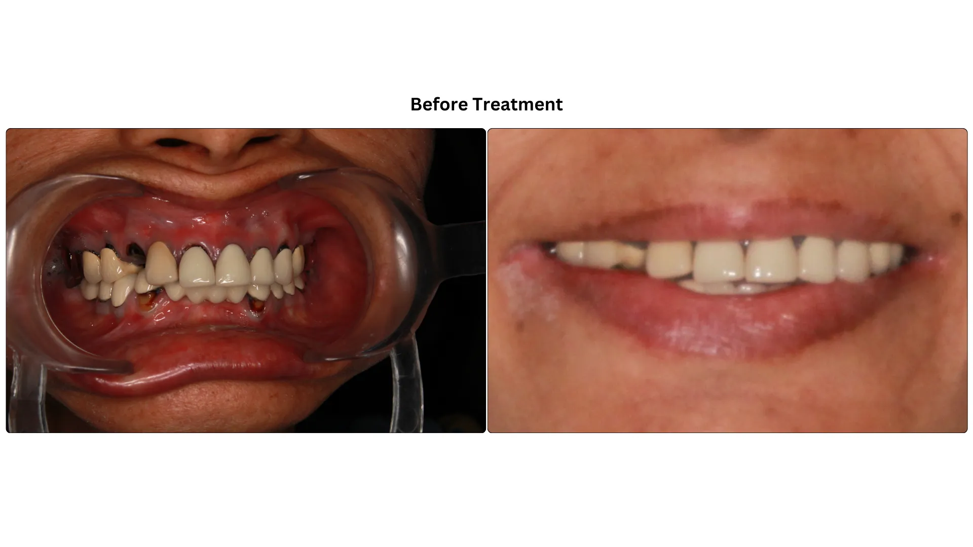 Daxayani before treatment