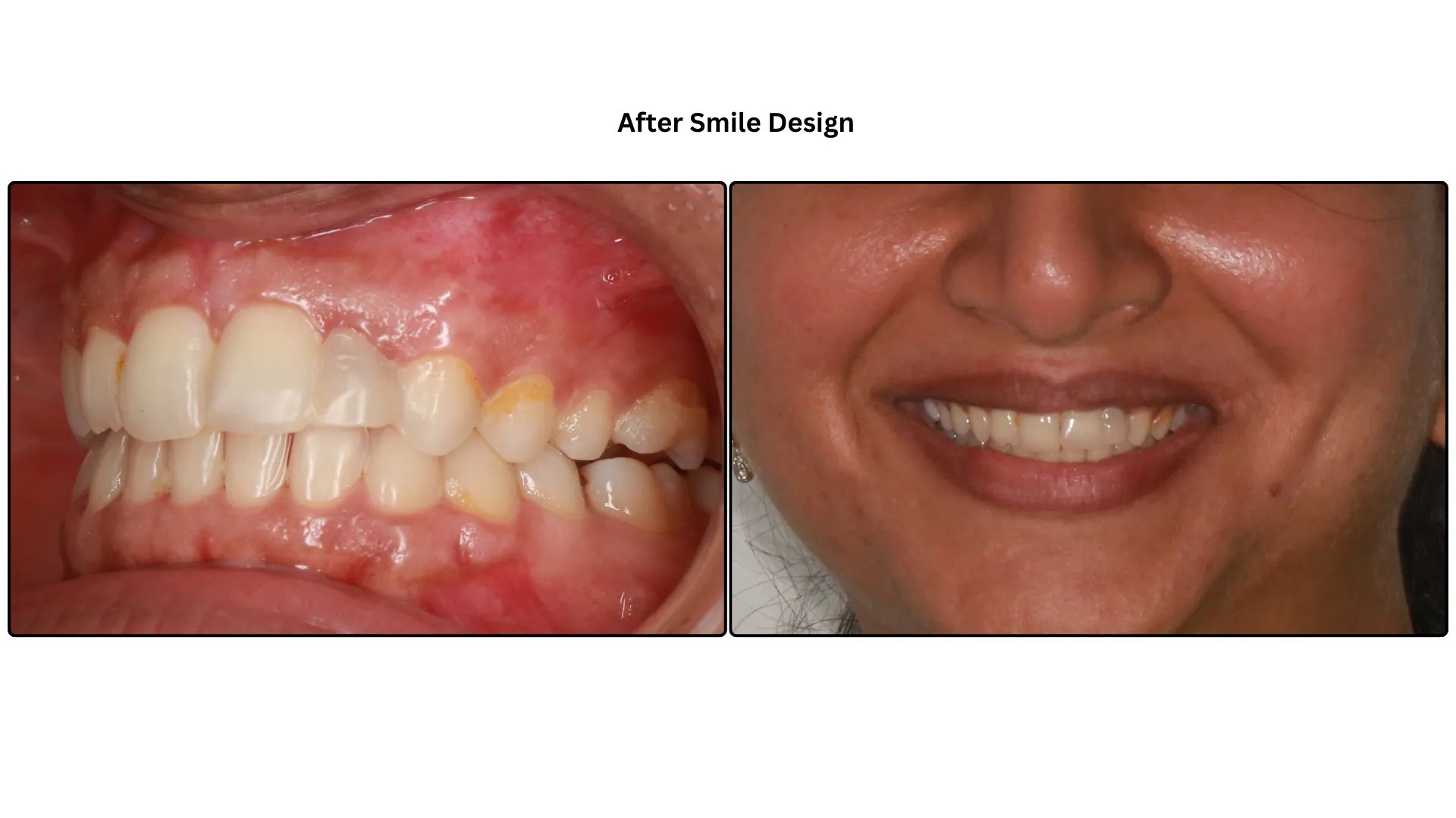 Daxayani after treatment
