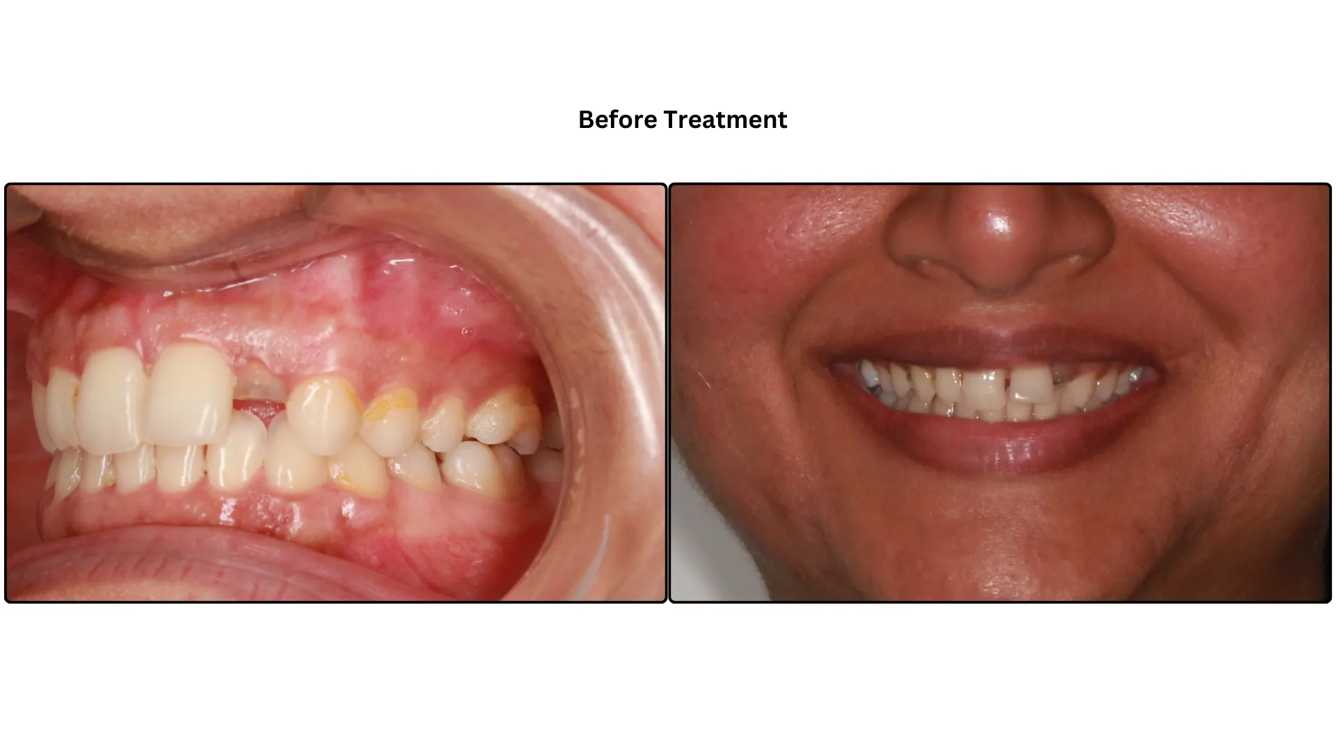 Daxayani before treatment