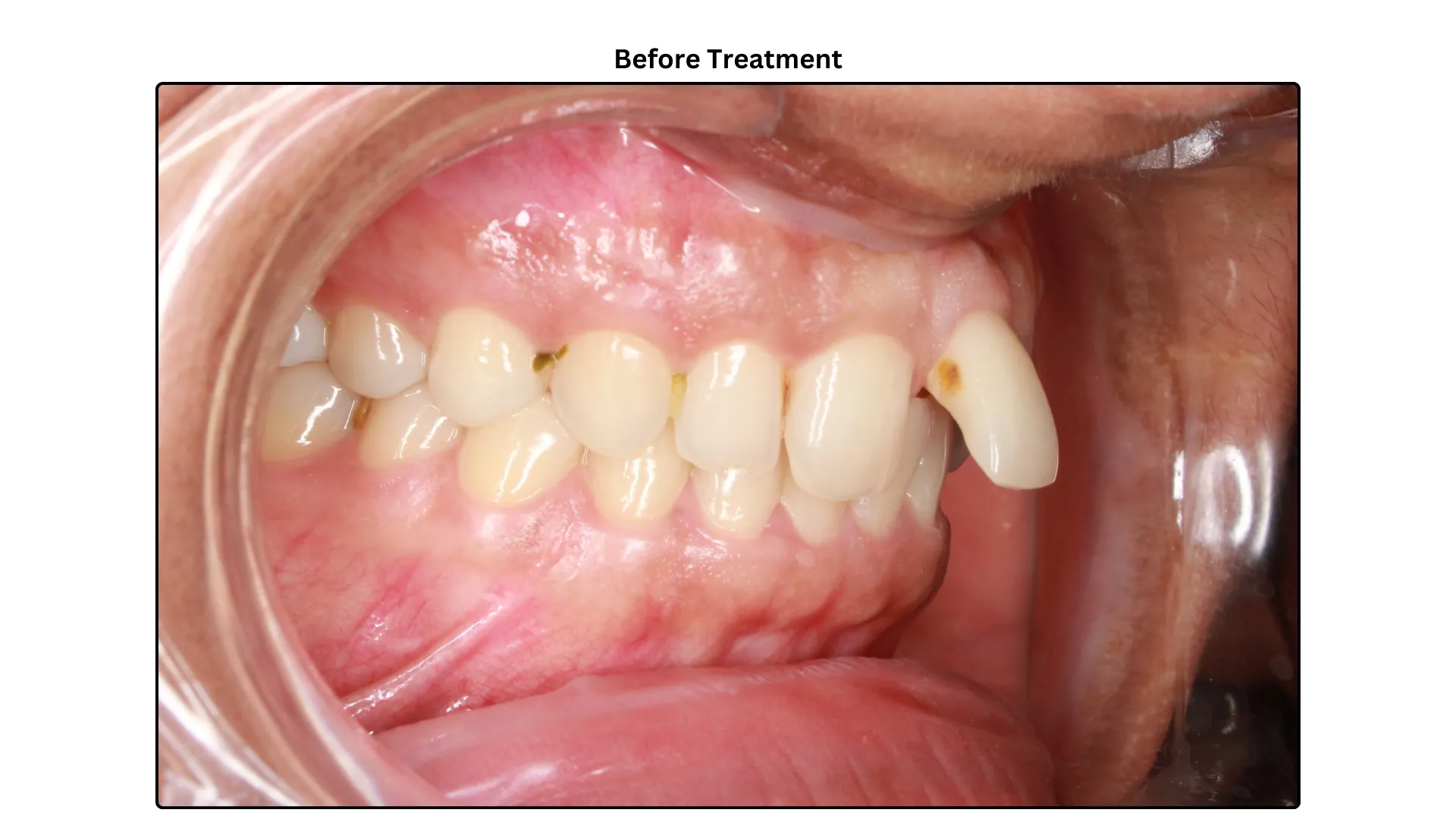Daxayani before treatment