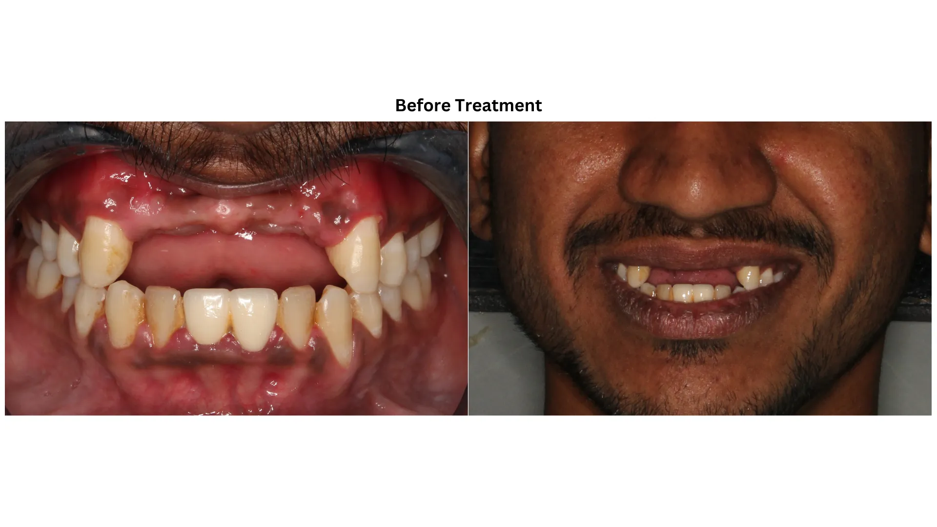 Daxayani before treatment