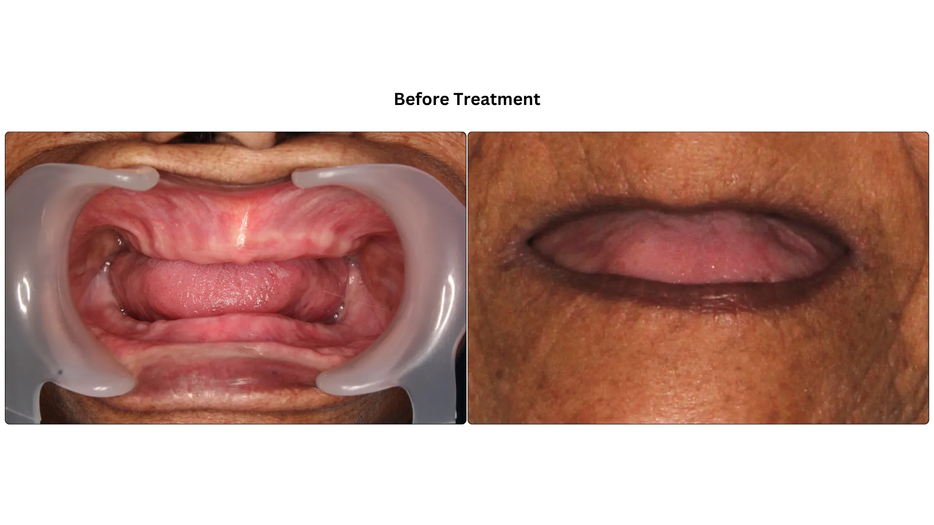 Daxayani before treatment