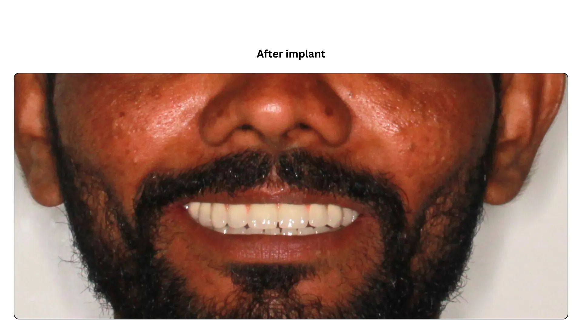 Daxayani after treatment