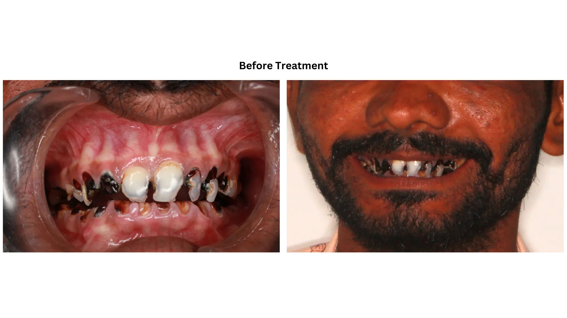 Daxayani before treatment